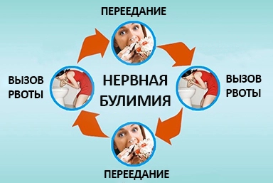 Лечение булимии в Новомихайловском